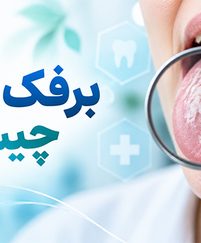 برفک دهان چیست