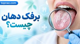 برفک دهان چیست؟؛ علائم و علتهای عفونت کاندیدا؛ درمان و راههای کاهش عود برفک دهان چیست