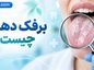 برفک دهان چیست؟؛ علائم و علتهای عفونت کاندیدا؛ درمان و راههای کاهش عود برفک دهان چیست