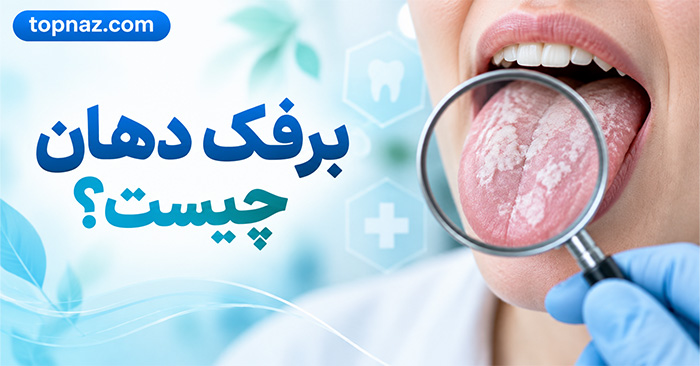 برفک دهان چیست؟؛ علائم و علتهای عفونت کاندیدا؛ درمان و راههای کاهش عود برفک دهان چیست؟؛ علائم و علتهای عفونت کاندیدا؛ درمان و راههای کاهش عود