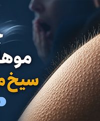 چرا موهای بدن سیخ می‌شوند