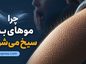 چرا موهای بدن سیخ میشوند؟؛ علت علمی Goosebumps؛ نقش سرما، ترس و سیستم عصبی سمپاتیک چرا موهای بدن سیخ میشوند