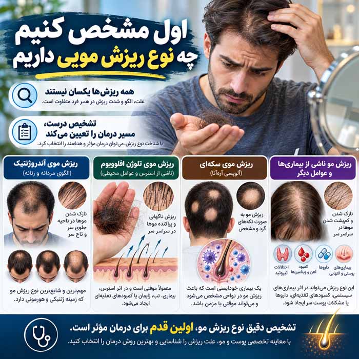ماینوکسیدیل یا فیناستراید؛ کدام برای ریزش مو مؤثرتر است؟؛ مقایسه عملکرد، نتایج و عوارض اول مشخص کنیم چه نوع ریزش مویی داریم