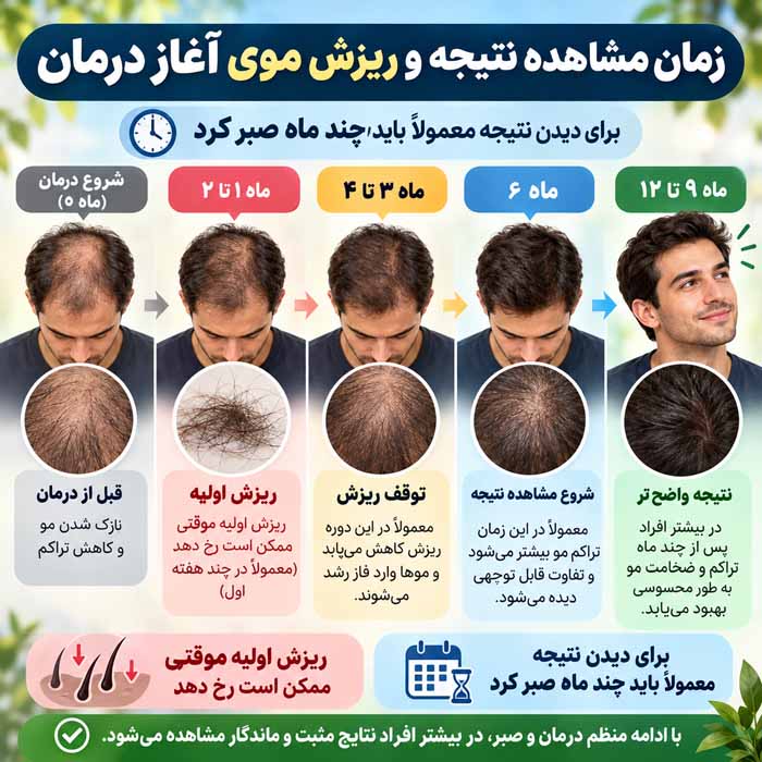 ماینوکسیدیل یا فیناستراید؛ کدام برای ریزش مو مؤثرتر است؟؛ مقایسه عملکرد، نتایج و عوارض زمان مشاهده نتیجه و ریزش موی آغاز درمان