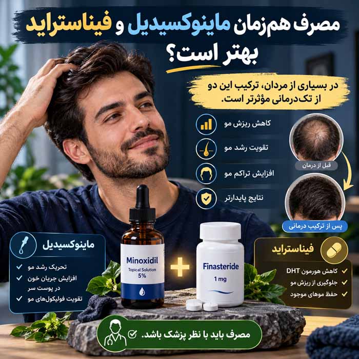 ماینوکسیدیل یا فیناستراید؛ کدام برای ریزش مو مؤثرتر است؟؛ مقایسه عملکرد، نتایج و عوارض مصرف همزمان ماینوکسیدیل و فیناستراید بهتر است؟