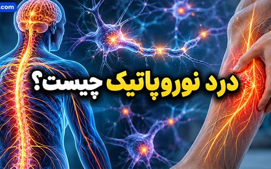 درد نوروپاتیک چیست؟ علائم درد عصبی، علت‌ها و روش‌های تشخیص و درمان