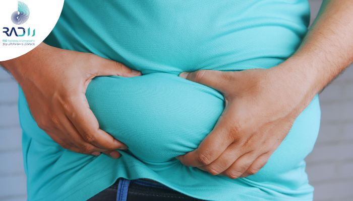 چرا 90٪ مبتلایان به کبد چرب خیلی دیر متوجه وضعیت واقعی کبدشان می‌شوند؟