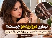 بیماری مروارید مو چیست؟ علائم، علت، تشخیص، درمان و راههای مراقبت از مو بیماری مروارید مو چیست؟ علائم، علت، تشخیص، درمان و راههای مراقبت از مو