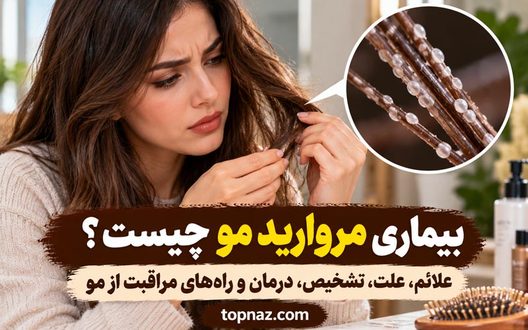 بیماری مروارید مو چیست؟ علائم، علت، تشخیص، درمان و راه‌های مراقبت از مو