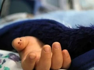 مرگ تلخ دختر سه‌ساله بر اثر عقرب‌گزیدگی در قلعه‌گنج